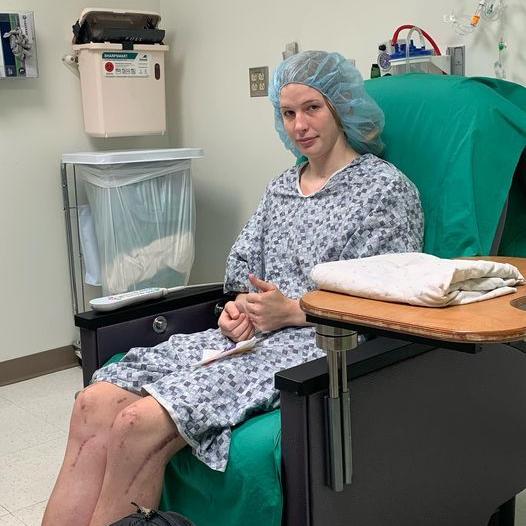 AVA JONES LATEST SHOULDER SURGERY PIC.jpg